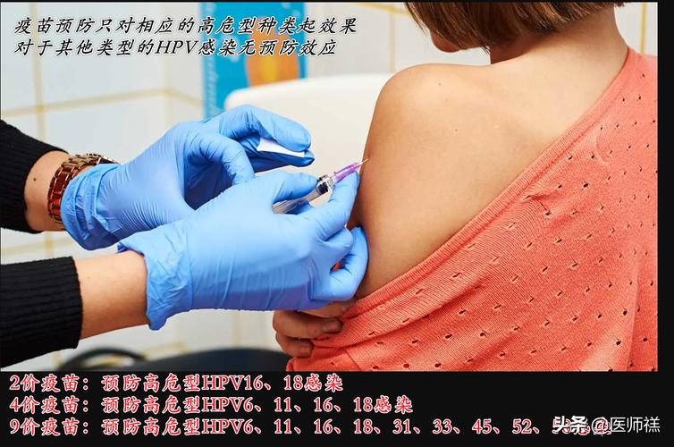 宮頸癌疫苗多少錢二價(jià)四價(jià)九價(jià)哪個(gè)值得打